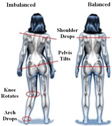 Comparison of female body posture showing dropped shoulders, pelvic tilt, knee rotation, and ankle drop to illustrate mechanical issues at Physio Barnsley.