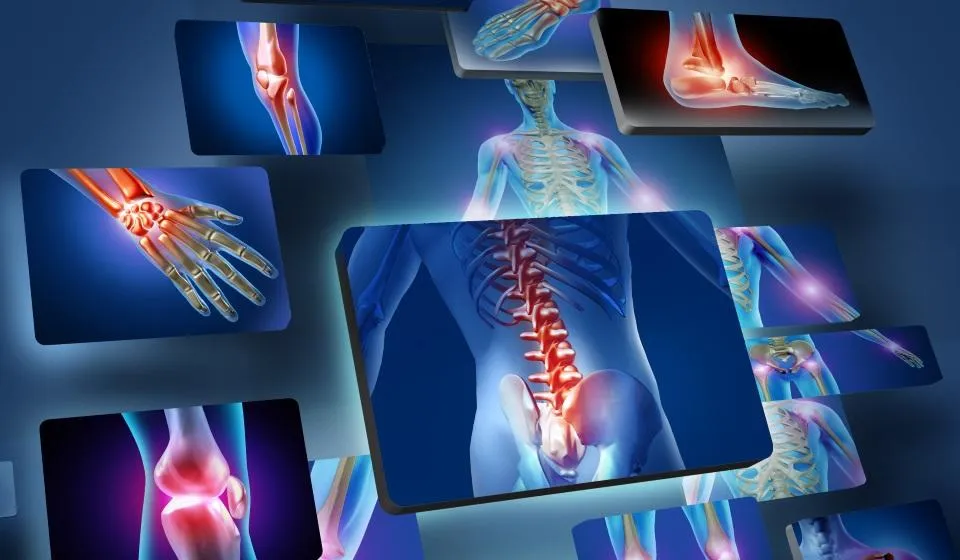 Illustration of human body with highlighted zones for common sports injuries at Physio Barnsley.