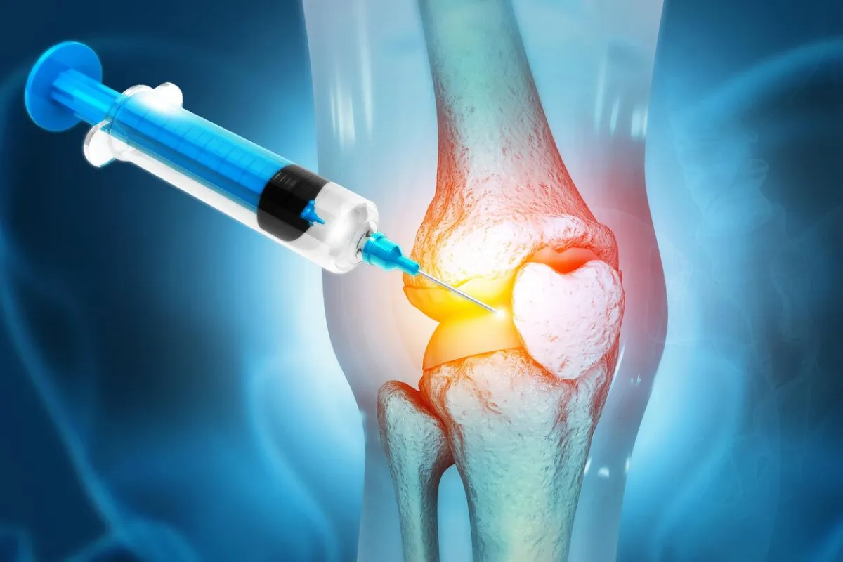 Illustration of Prolozone injection in the knee joint, representing regenerative ozone therapy at Physio Barnsley.