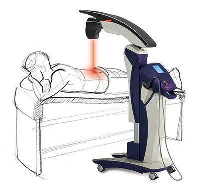 MLS® Laser Therapy in Novato, CA