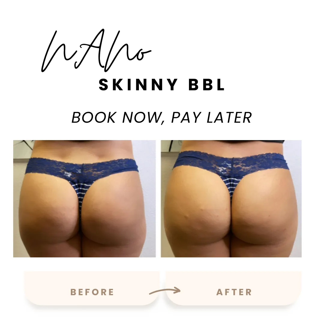 green and purple flower in water