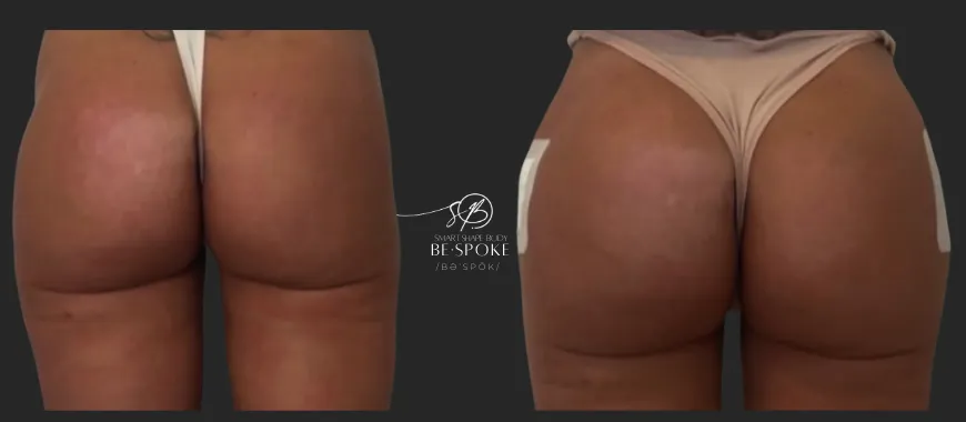 green and purple flower in water