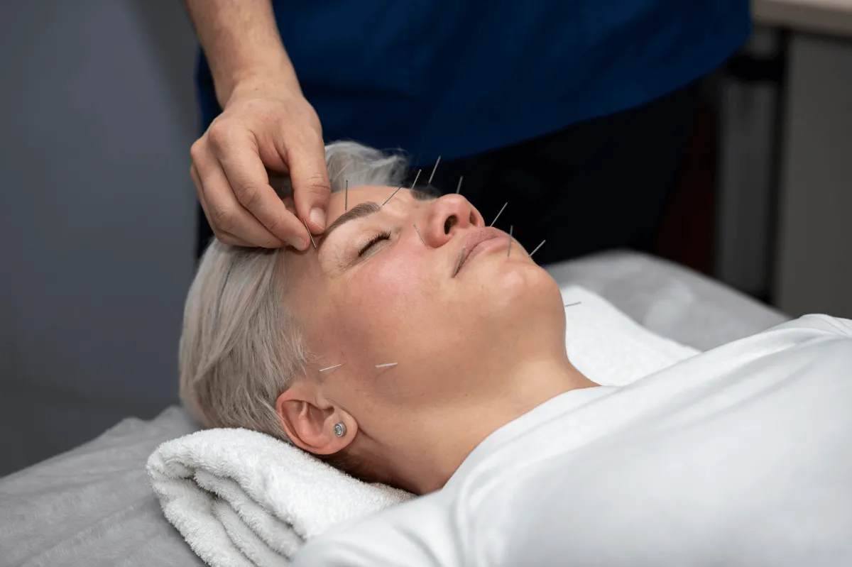 Acupuncture for Migraines in NYC