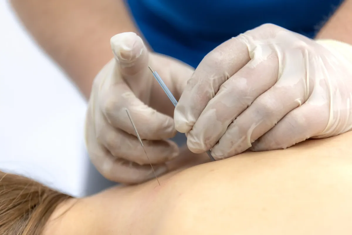 Acupuncture for Herniated Disc Pain in NYC