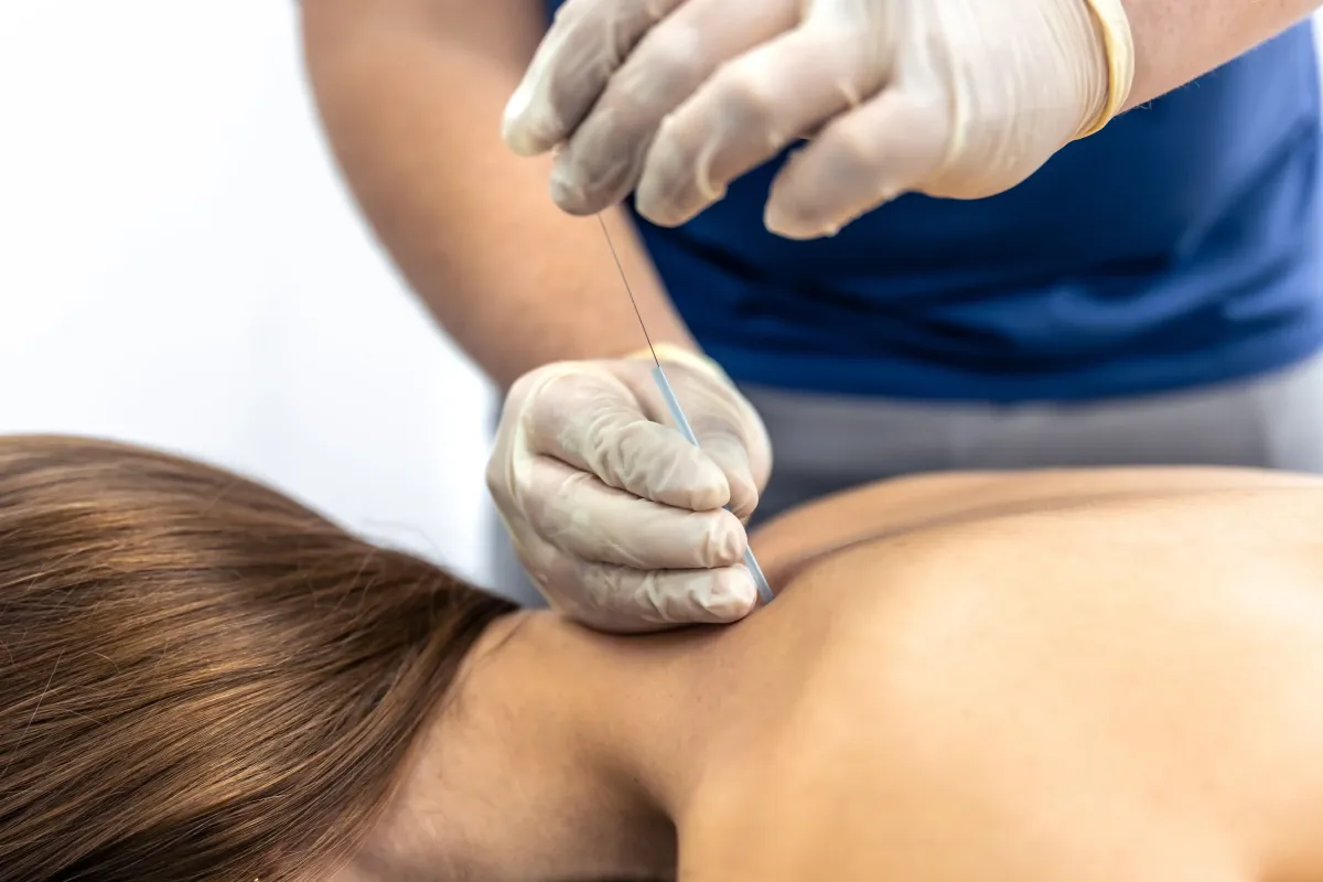 Dry Needling for Neck Pain in NYC
