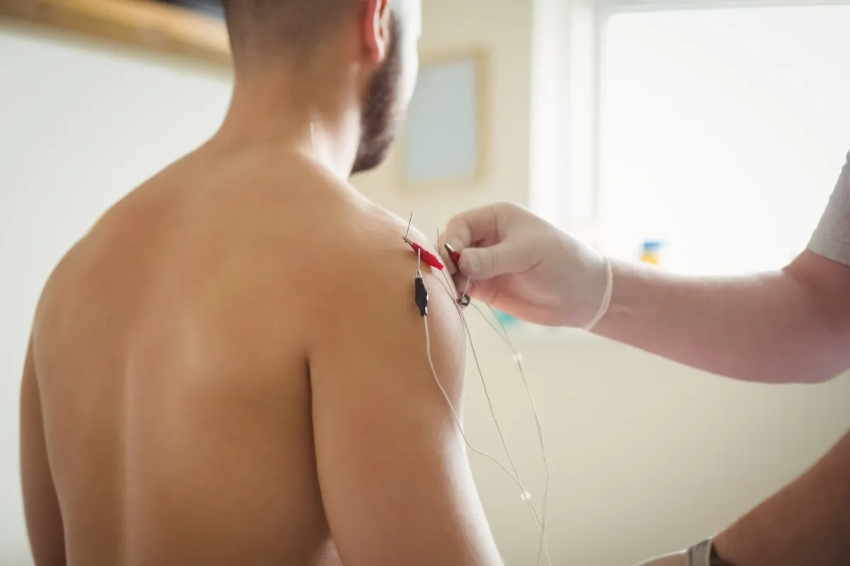 Dry Needling for Shoulder Pain in NYC
