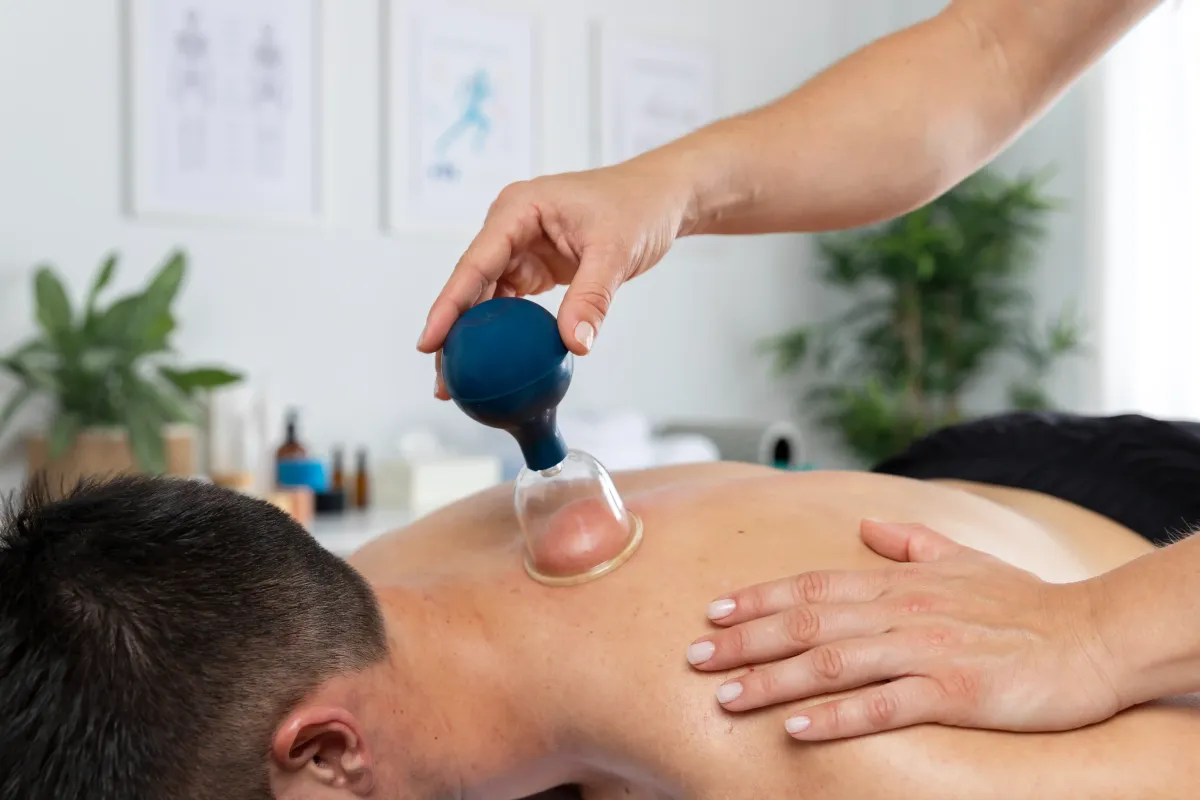 Cupping Therapy for Muscle Pain in NYC