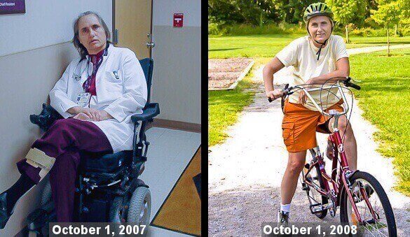 Terry Wahls MD: The Miracle of Nutrition | Feed a Brain