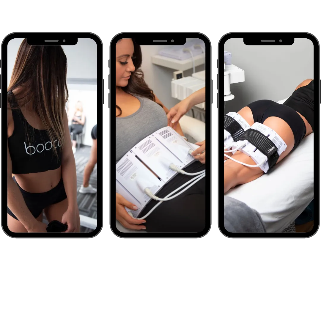 bodcor body contouring 