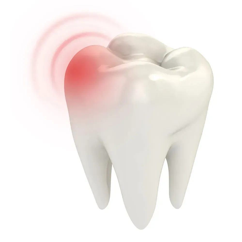 Tooth Pain Relief
