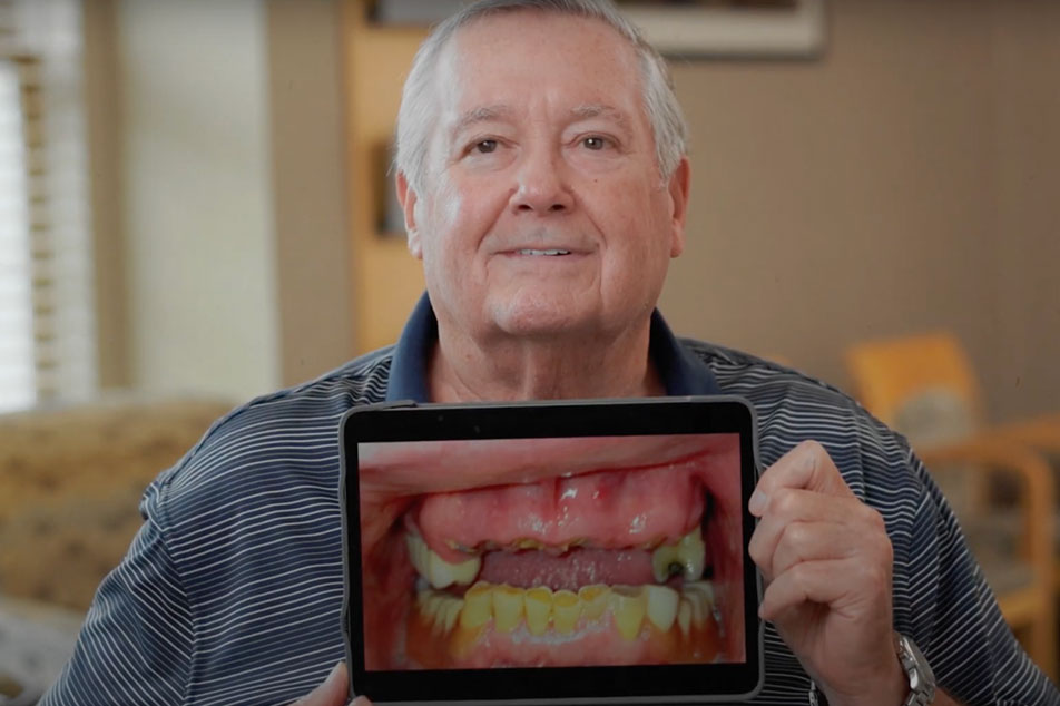 Couple Smiling with Perfect Teeth