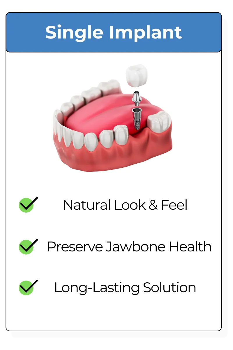 Single Dental Implant