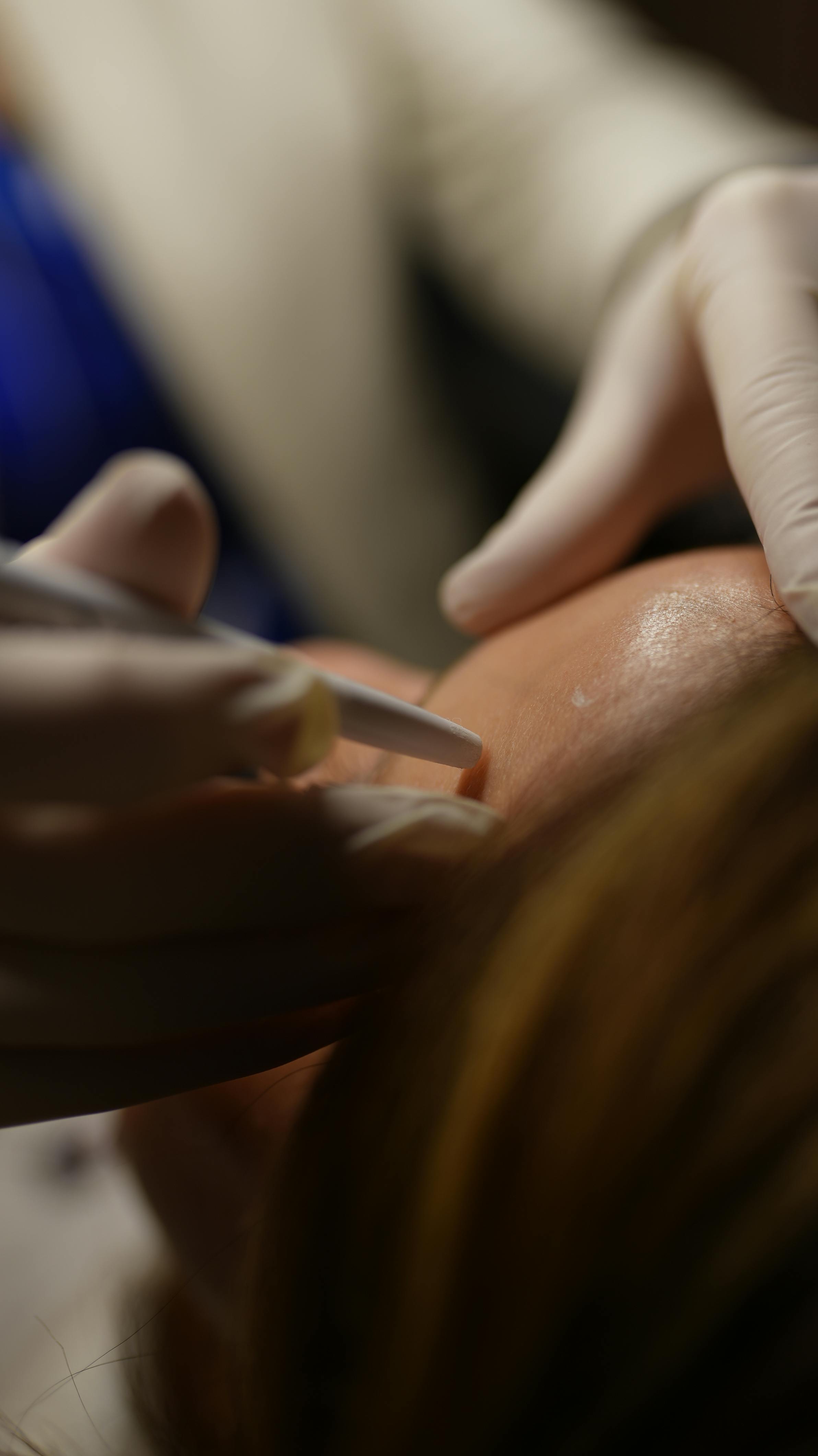 Microneedling: What It Is, How It Works, and Why It’s One of the Most Effective Skin Treatments Available