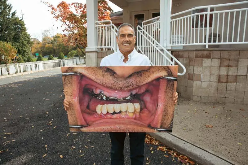 white and pink dentures