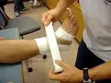 An athletic trainer or physiotherapist taping a patient's ankle after receiving a grade 3 ankle sprain 