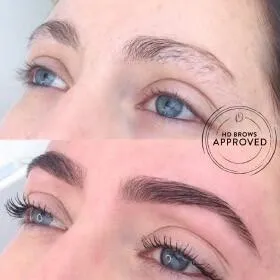 Before and After HD Brows Treatment