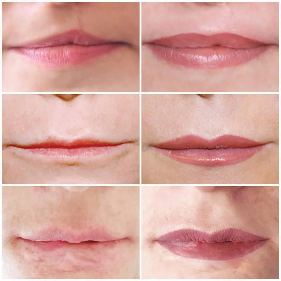 A series of before and afters for Lip Line a Blush 