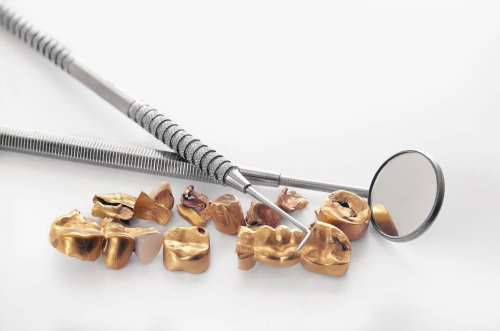 How to Sell Dental Gold Near You