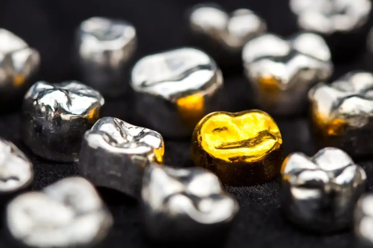How Much Is a Gold Tooth Worth? Value, Price, and Where to Sell It