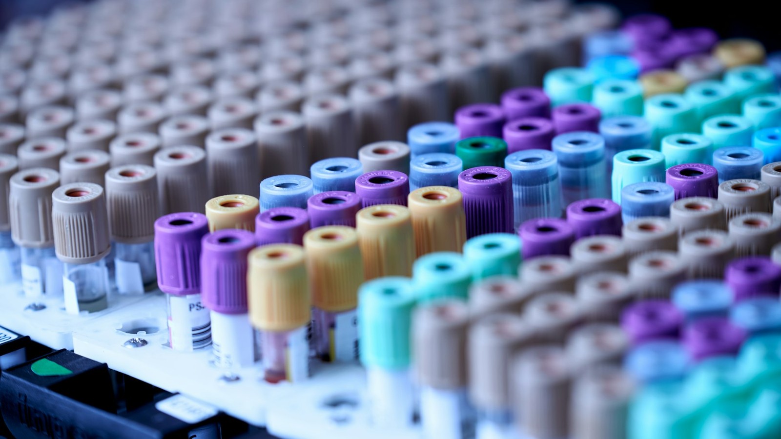 Rows of colour-capped blood collection tubes in a laboratory rack ready for a metabolic blood panel
