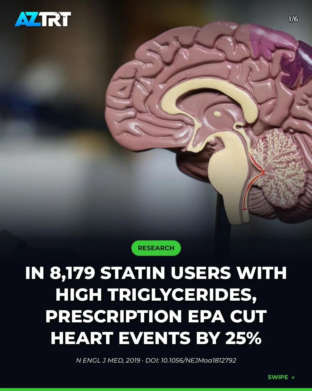 REDUCE-IT: Prescription EPA Cut Heart Events 25% in Statin Users
