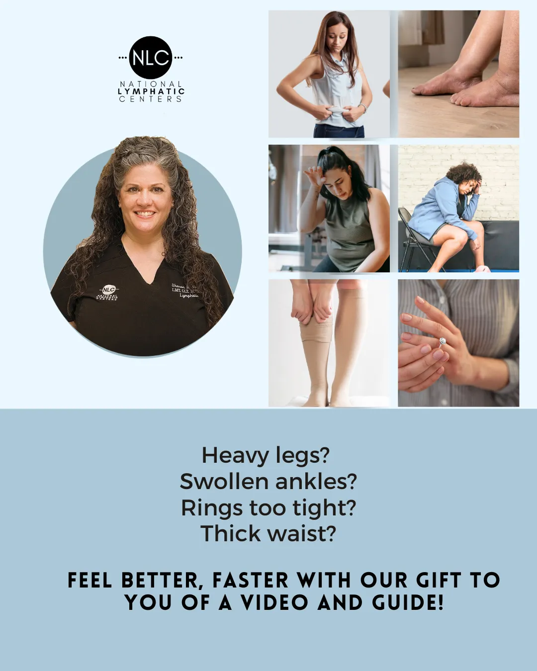 swollen ankles, lymphedema, big legs,