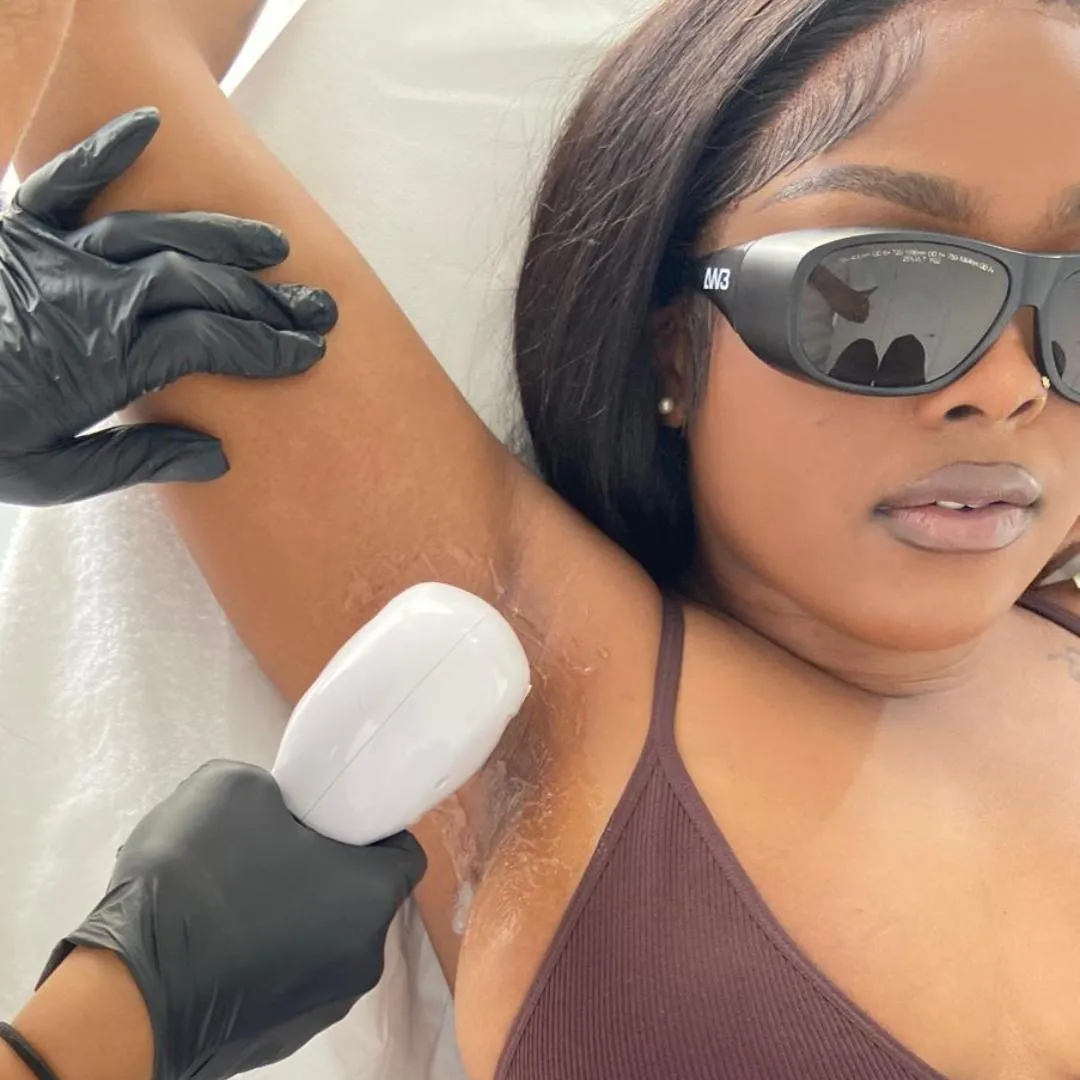 Laser location laser hair removal underarm