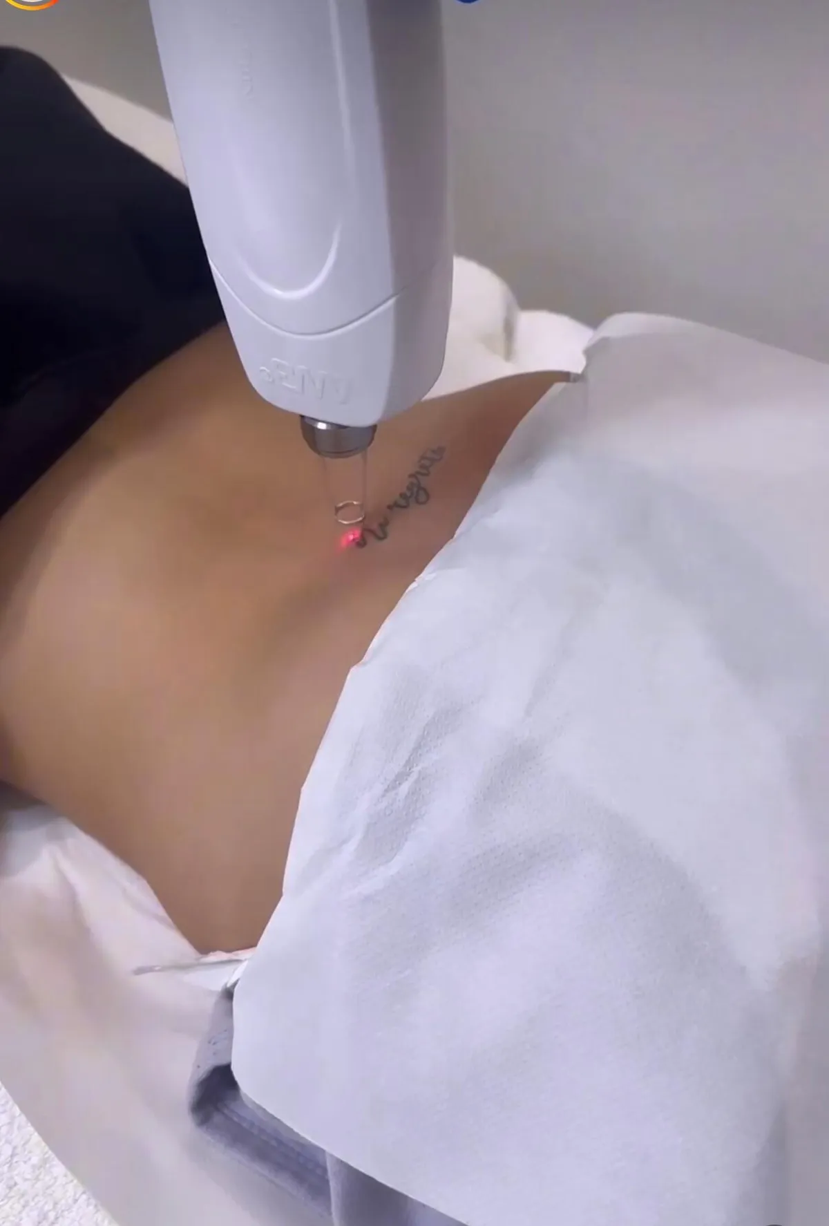 Laser Tattoo Removal at LaserLocation Manchester