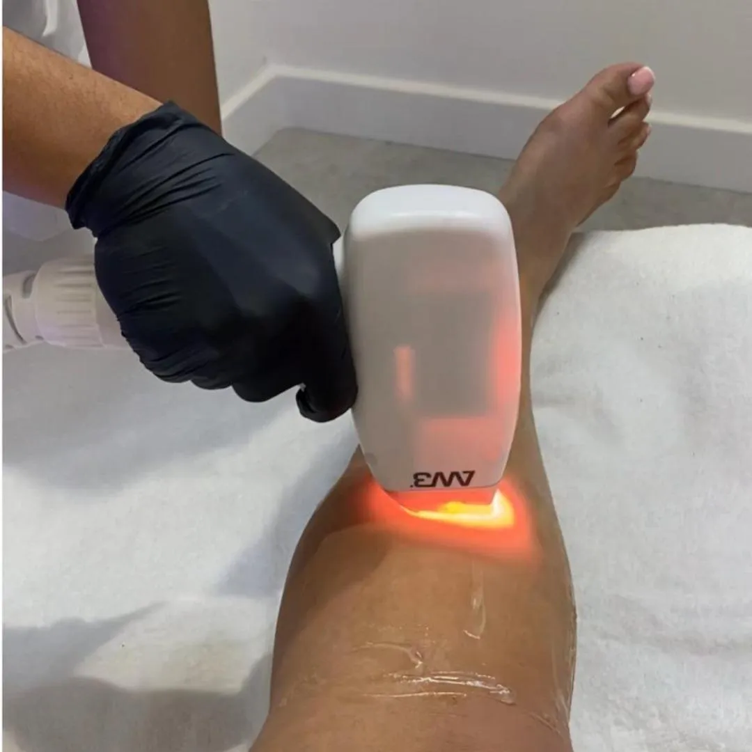 Laser Location hair removal leg treatment area