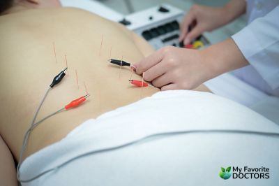 electro-acupuncture in longwood fl