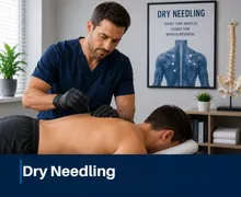 Dry Needling