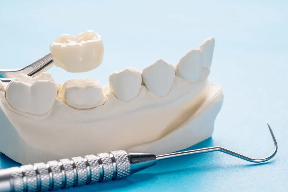 Crowns and their Function