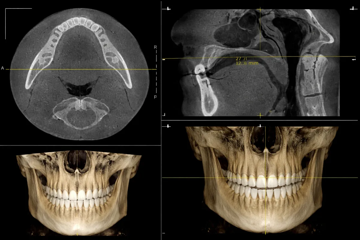Are Dental CBCT's Overdone To Generate Revenues?