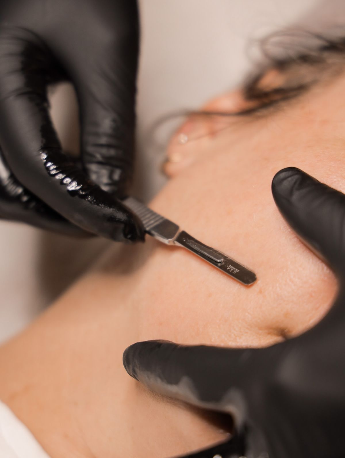 Dermaplaning Care