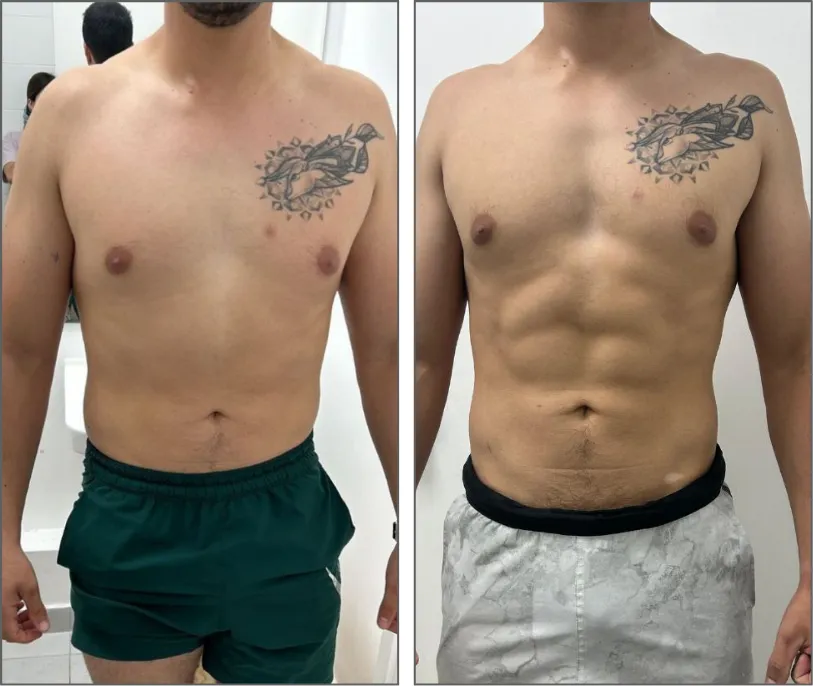 Antes y después · Pedro Opazo · transformación física FitinSix