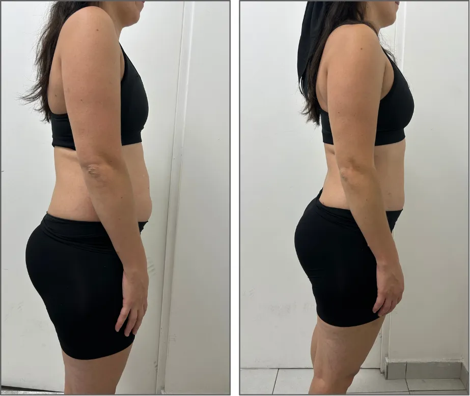 Antes y después · Martina H · transformación física FitinSix