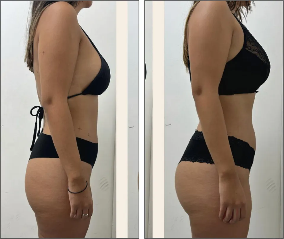Antes y después · Catalina Prado · transformación física FitinSix
