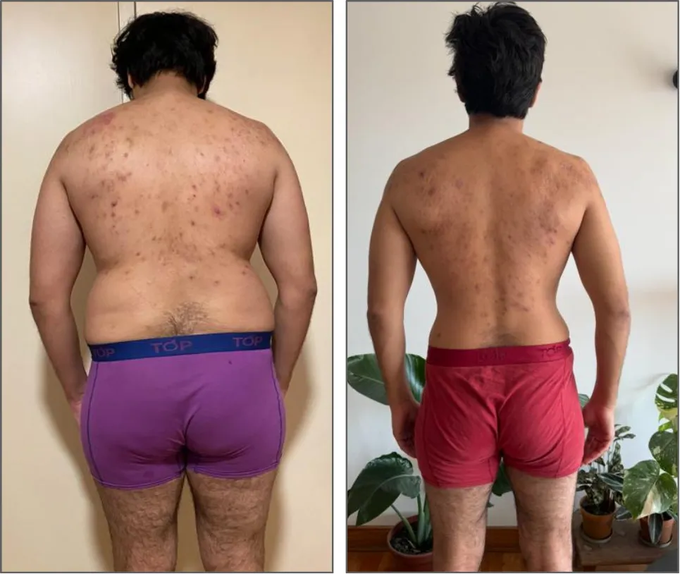 Antes y después · Tomás B · transformación física FitinSix