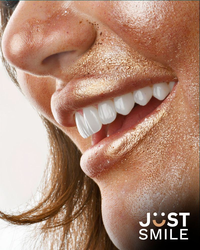Just Smile Miami — premium porcelain veneer smile