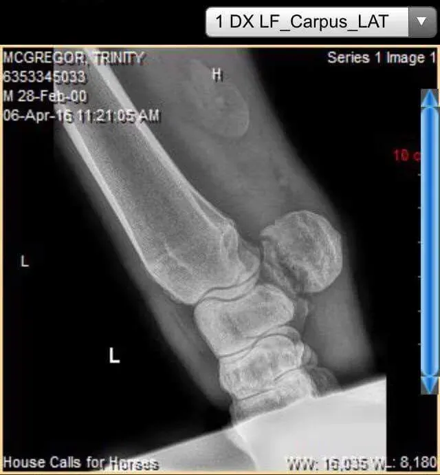 xray of after