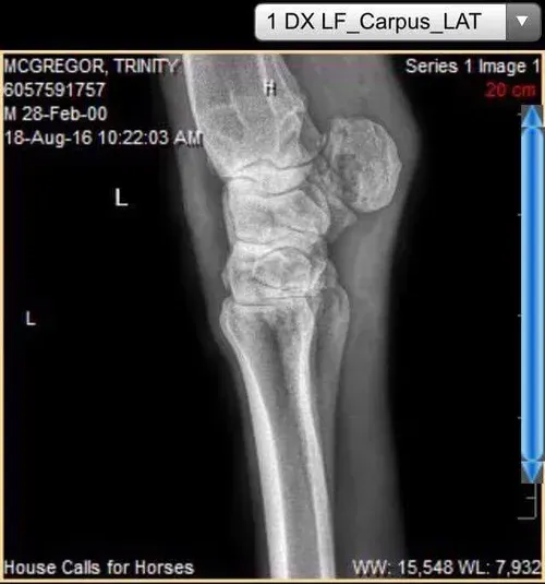 x-ray of before