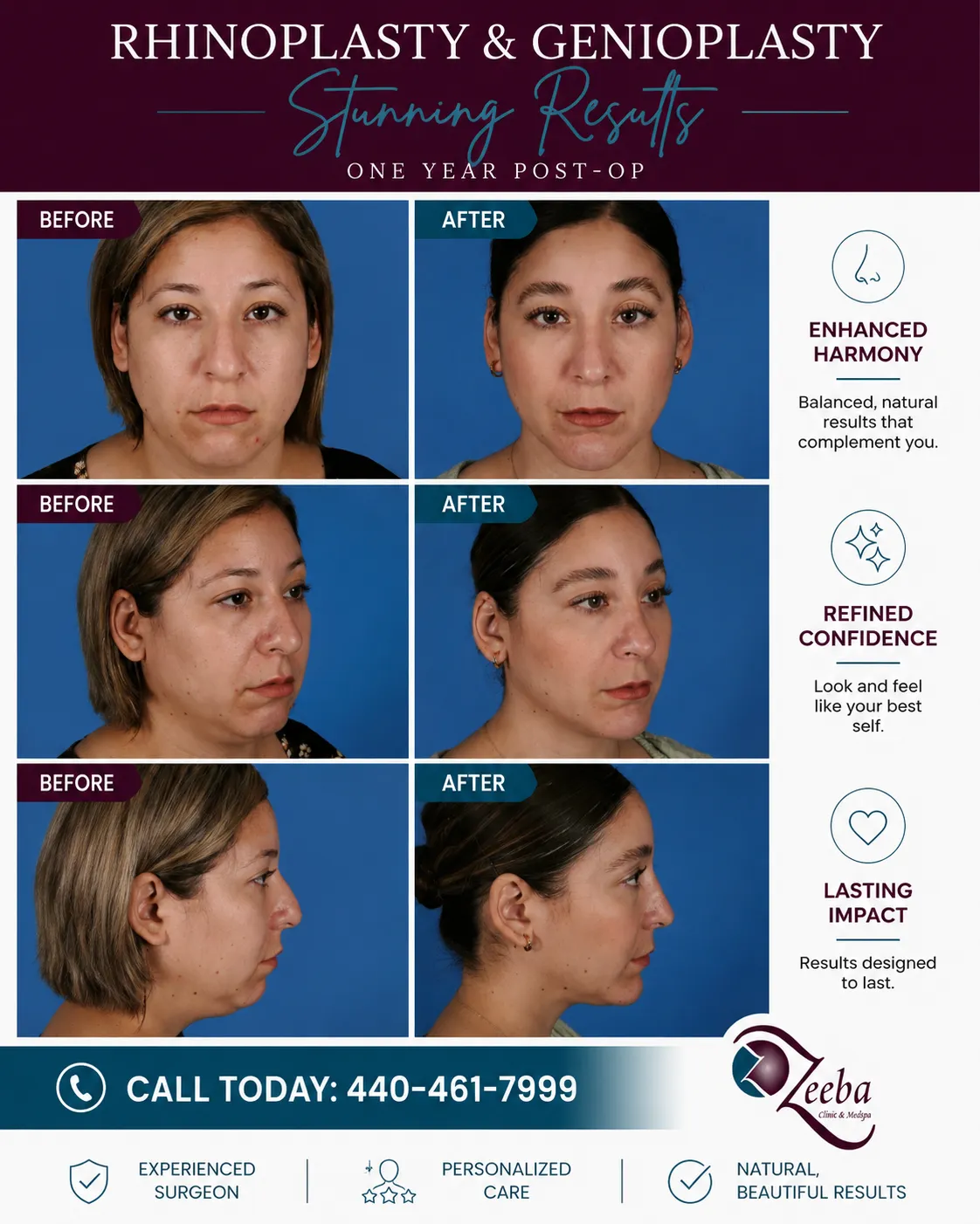 Before and After Placeholder case study 03