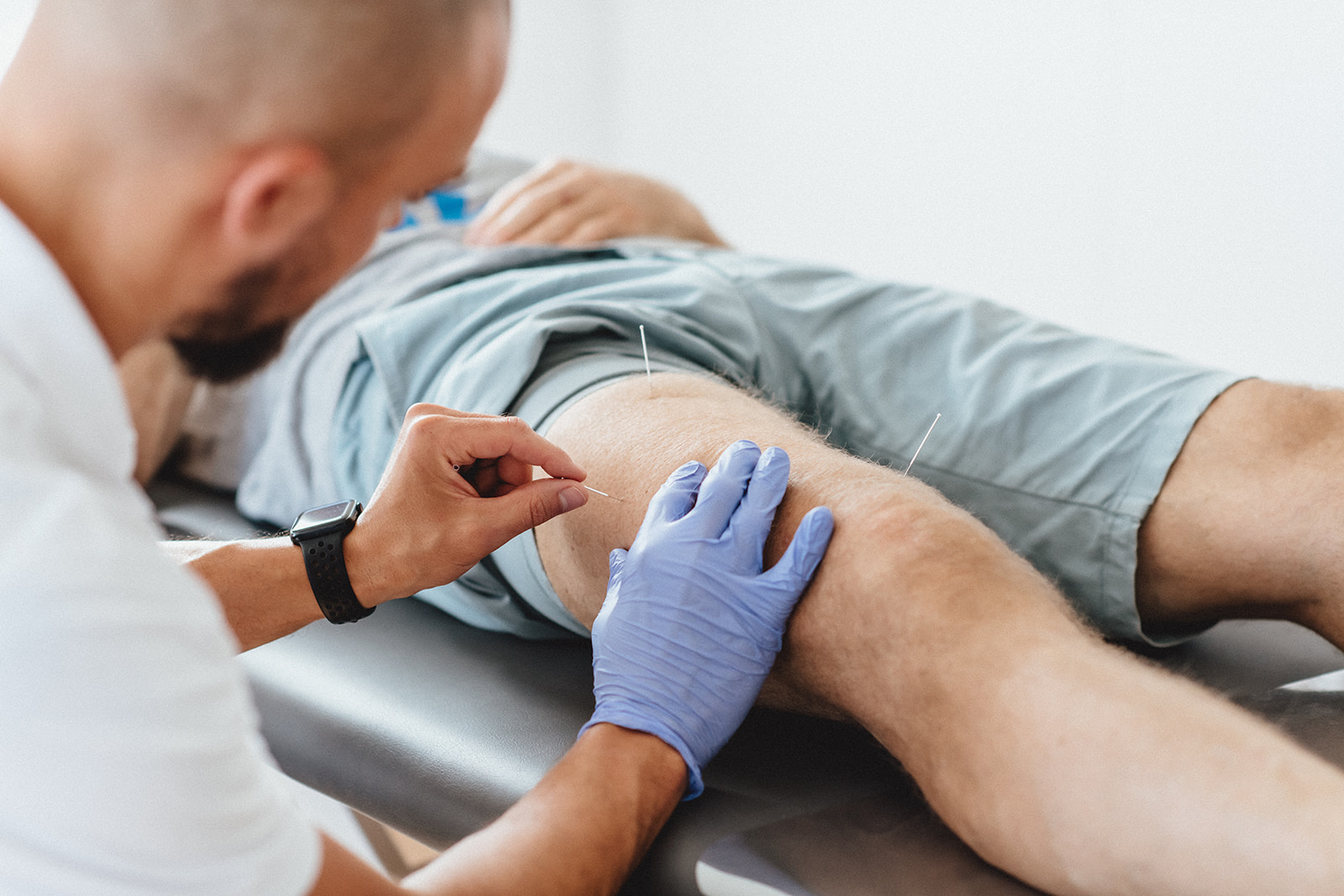 Gezielte Behandlung von Triggerpunkten zur Lösung muskulärer Verspannungen.