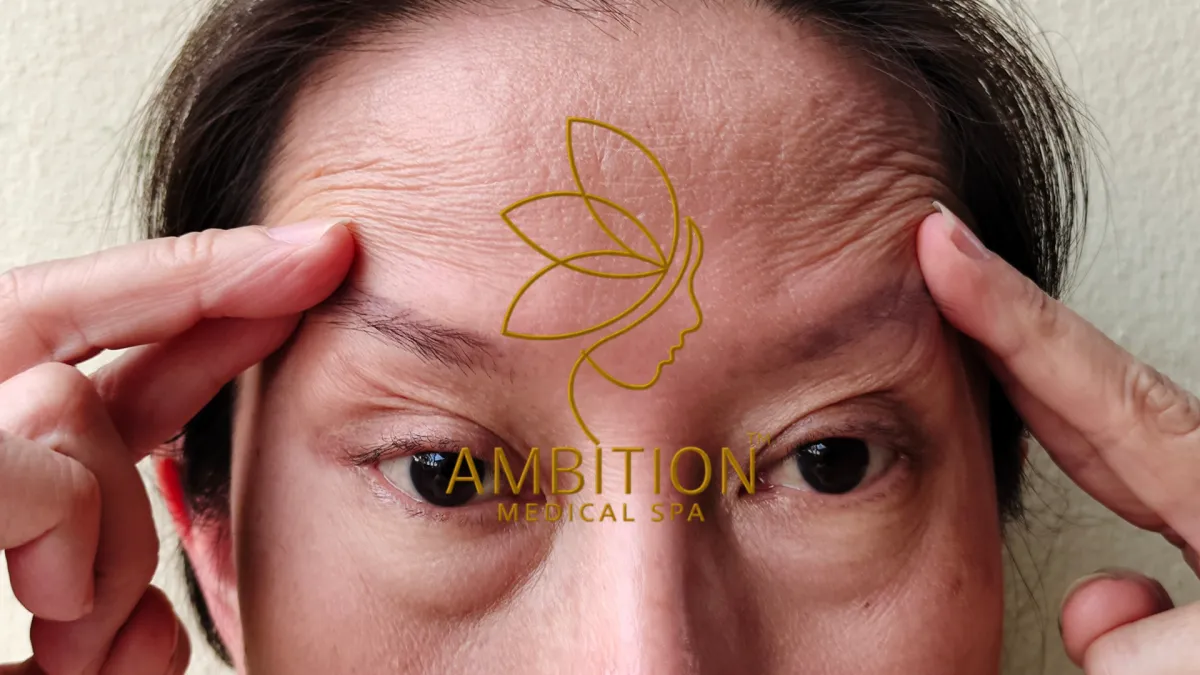 Ambition Medical Spa | What are Fine Lines?