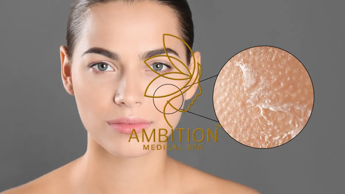 Ambition Medical Spa | What is Flaky Skin?