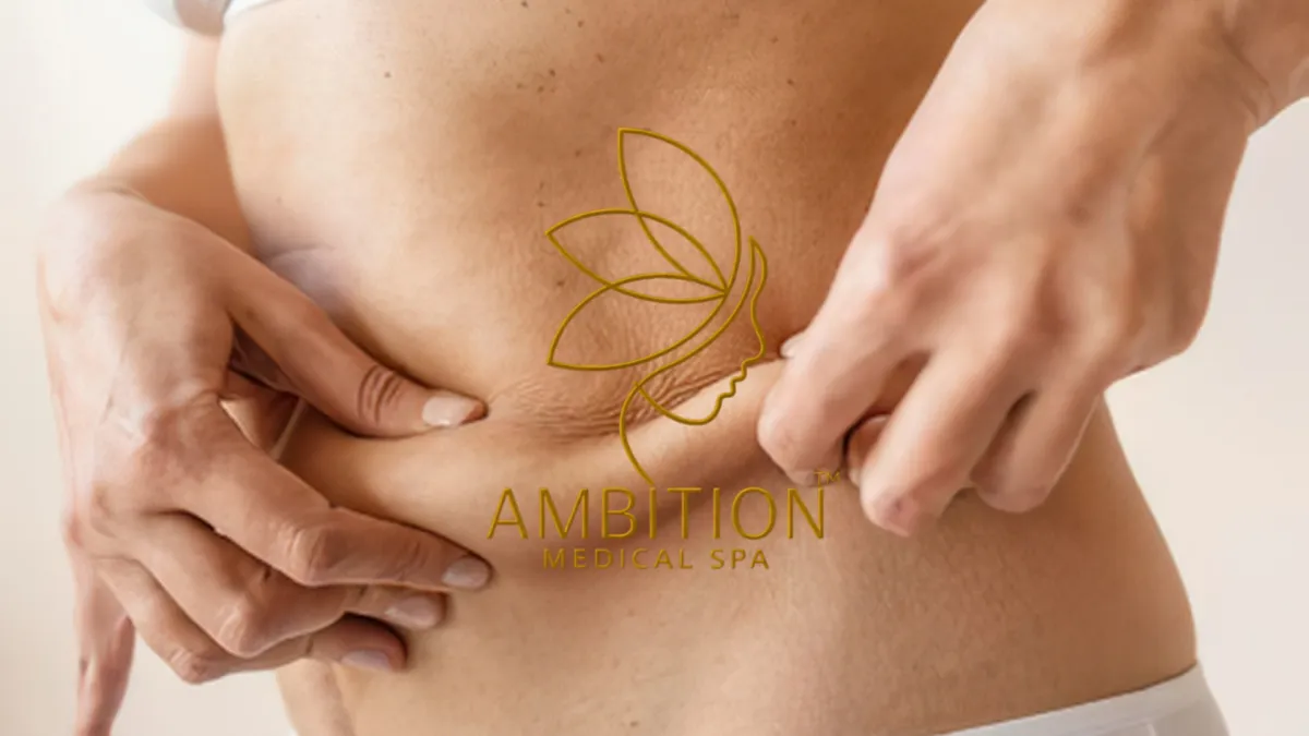 Ambition Medical Spa | What is Saggy Skin?