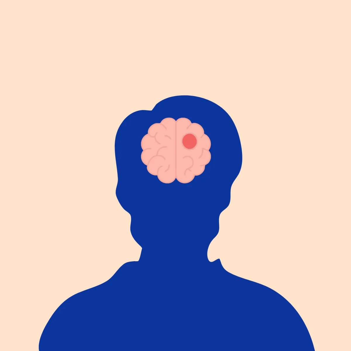 Icon: Neurologische Logopädie Wien 1050. Rehabilitation bei Aphasie, Dysarthrie und Dysphagie nach Schlaganfall oder bei Parkinson.