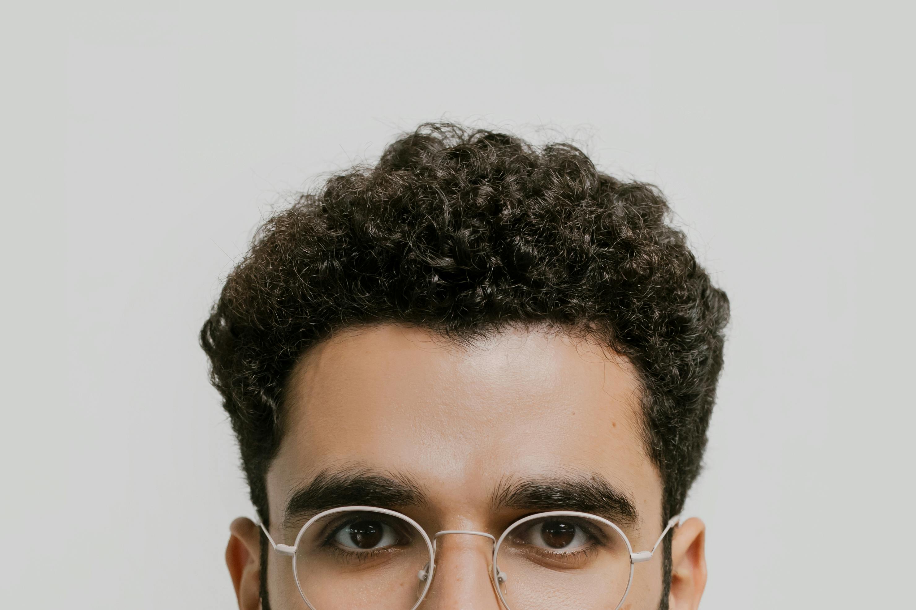 The Complete Guide to Hair Restoration Success: What to Expect from Start to Finish