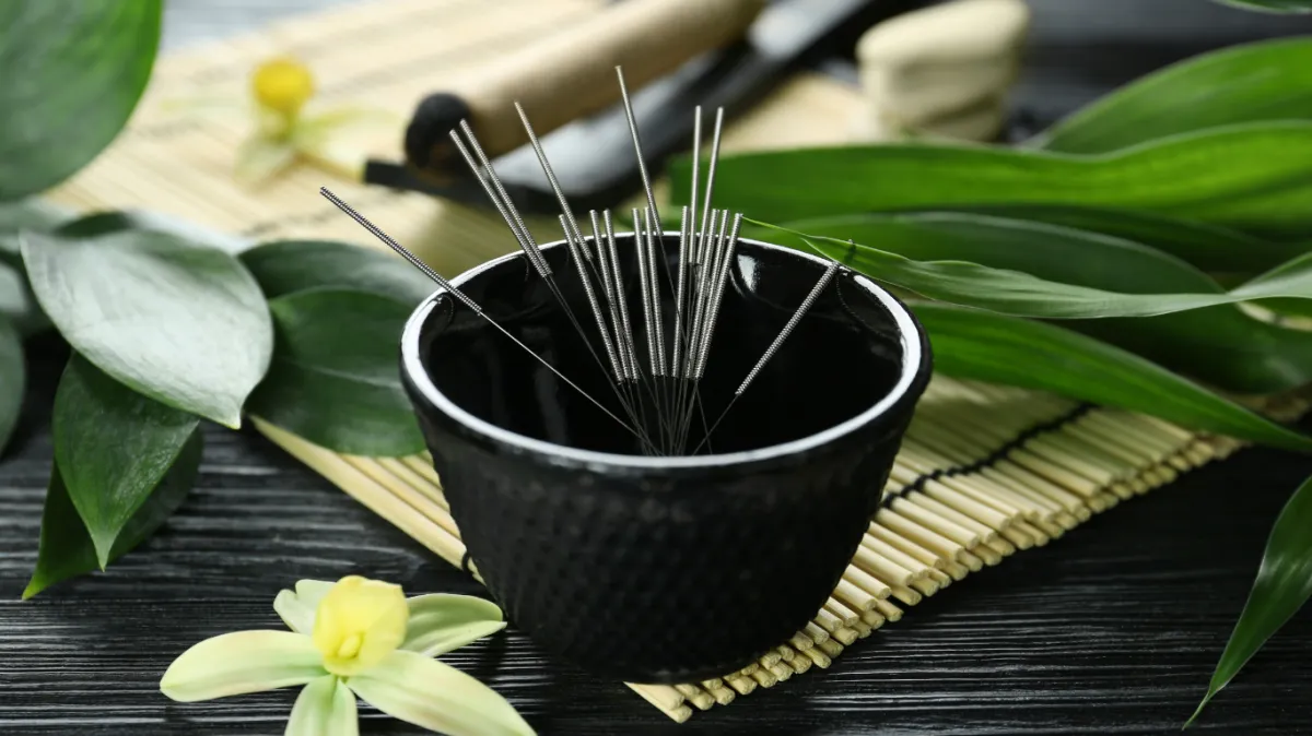 photo of woman during an acupuncture session