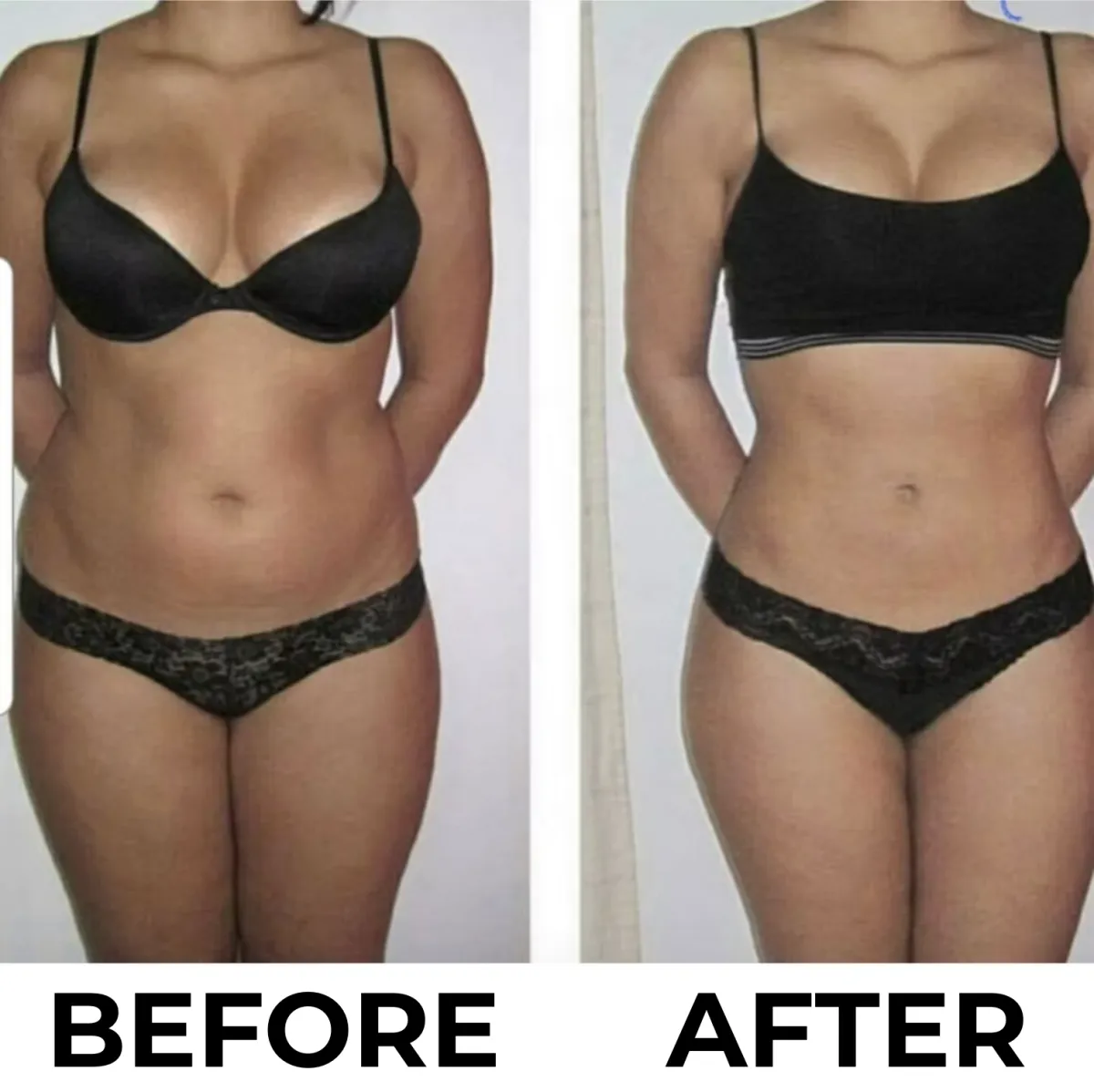 Before and after results example for [Your Flagship Treatment]